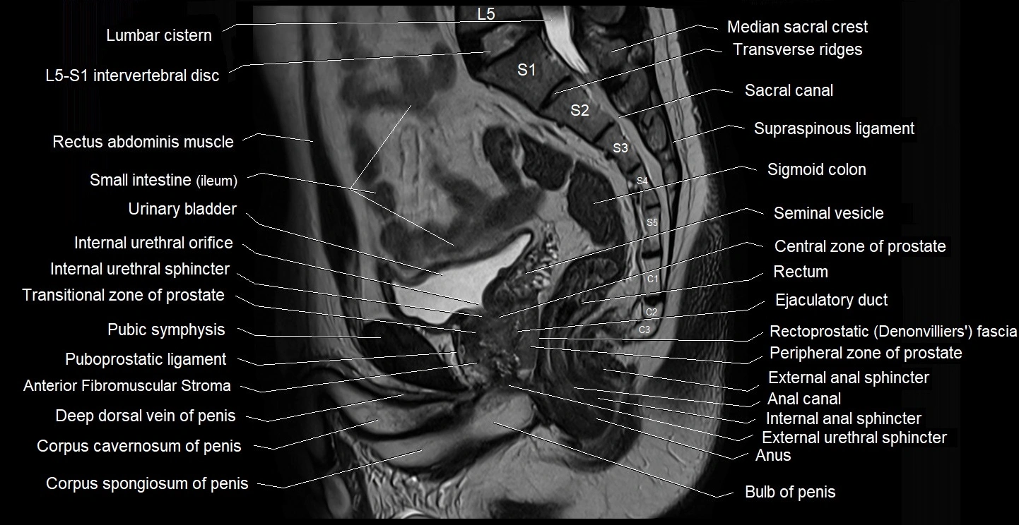 male pelvis sagittal cross sectional anatomy 3T mri image 24.webp
